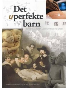 Det uperfekte barn