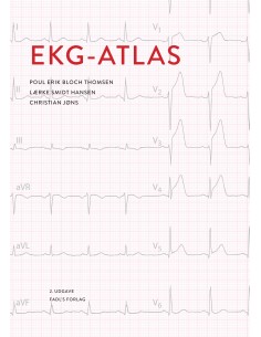 EKG-atlas