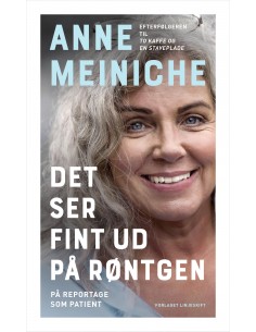 Det ser fint ud på røntgen