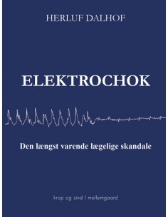 Elektrochok