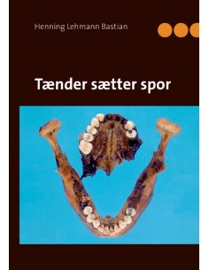 Tænder sætter spor