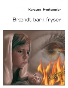 Brændt barn fryser